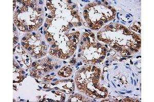 Immunohistochemical staining of paraffin-embedded liver tissue using anti-PASKmouse monoclonal antibody. (PASK 抗体)