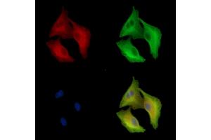 ABIN7097022 and ABIN7101089 staining  cells by IF/ICC.