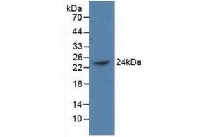 Western blot analysis of recombinant Human PCGF4. (BMI1 抗体  (AA 152-289))