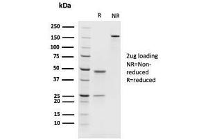 SDS-PAGE Analysis Purified PAX8 Recombinant Mouse Monoclonal Antibody (rPAX8/1492). (Recombinant PAX8 抗体  (AA 60-261))