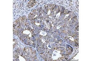 IHC analysis of CCNB1 using anti-CCNB1 antibody (ABIN7599335).