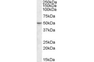 Image no. 1 for anti-TEA Domain Family Member 2 (TEAD2) (Internal Region) antibody (ABIN375139) (TEAD2 抗体  (Internal Region))