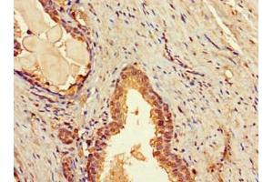 Immunohistochemistry of paraffin-embedded human prostate tissue using ABIN7171658 at dilution of 1:100 (TBC1D7 抗体  (AA 1-293))