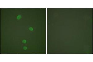 Immunofluorescence analysis of HepG2 cells, using MCM5 antibody (ABIN5976453).