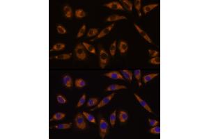 anti-Guanine Nucleotide Binding Protein (G Protein), Q Polypeptide (GNAQ) (AA 1-359) antibody