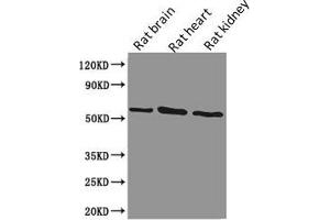 Western Blot Positive WB detected in: Rat brain tissue, Rat heart tissue, Rat kidney tissue All lanes: PODXL antibody at 1. (PODXL 抗体)