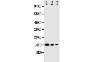 Western Blotting (WB) image for anti-Interleukin 4 (IL4) (AA 72-88), (Middle Region) antibody (ABIN3044141) (IL-4 抗体  (Middle Region))