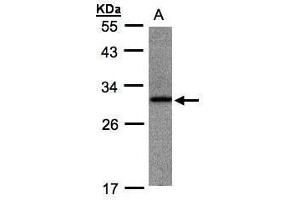 WB Image Sample(30 ug whole cell lysate) A:Raji , 10% SDS PAGE antibody diluted at 1:1000 (ANKRD7 抗体)