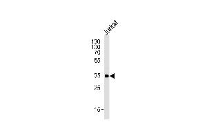 Western blot analysis of lysate from Jurkat cell line,using FCGR2A Antibody (C-term) (ABIN652864 and ABIN2842562). (FCGR2A 抗体  (C-Term))