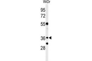 Western Blotting (WB) image for anti-Non-SMC Element 4 Homolog A (NSMCE4A) antibody (ABIN3004373) (NSMCE4A 抗体)