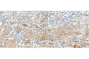Immunohistochemistry (Paraffin-embedded Sections) (IHC (p)) image for anti-Major Histocompatibility Complex, Class II, DR beta 3 (HLA-DRB3) antibody (ABIN7245239)