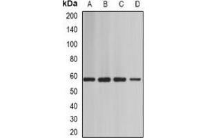 Western blot analysis of BAF60A expression in Jurkat (A), mouse heart (B), mouse testis (C), rat brain (D) whole cell lysates. (SMARCD1 抗体)