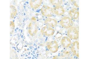 Immunohistochemistry of paraffin-embedded Mouse kidney using NRF2 Polyclonal Antibody at dilution of 1:100 (40x lens). (NRF2 抗体)