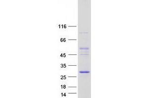 Validation with Western Blot (COMMD4 Protein (Myc-DYKDDDDK Tag))