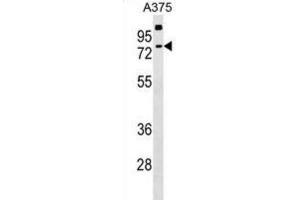 Western Blotting (WB) image for anti-Transketolase-Like 2 (TKTL2) antibody (ABIN2999404) (TKTL2 抗体)