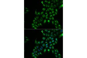 Immunofluorescence analysis of U2OS cells using TSPAN7 antibody. (Tetraspanin 7 抗体)