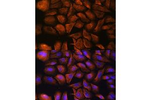 Immunofluorescence analysis of U-2 OS cells using Alpha Fodrin antibody (ABIN6128747, ABIN6148403, ABIN6148404 and ABIN6213643) at dilution of 1:100. (SPTAN1 抗体  (AA 950-1130))