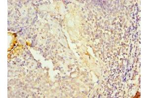 Immunohistochemistry of paraffin-embedded human tonsil tissue using ABIN7157487 at dilution of 1:100 (UPF0469 Protein KIAA0907 (KHDC4) (AA 1-241) 抗体)