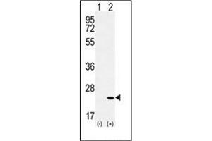 Western blot analysis of CRH (arrow) using Corticoliberin Antibody (C-term) Cat. (CRH 抗体  (C-Term))
