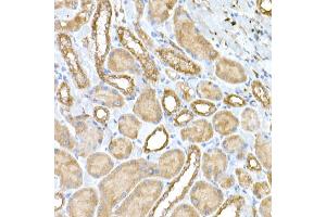 Immunohistochemistry of paraffin-embedded rat kidney using NPHP1 Rabbit pAb (ABIN6128349, ABIN6144768, ABIN6144769 and ABIN6222377) at dilution of 1:50 (40x lens). (NPHP1 抗体  (AA 345-614))