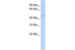 Western Blotting (WB) image for anti-3-phosphoinositide Dependent Protein Kinase-1 (PDPK1) (Middle Region) antibody (ABIN2777432)