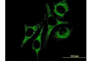 Immunofluorescence of purified MaxPab antibody to HSPD1 on HeLa cell. (HSPD1 抗体  (AA 1-573))