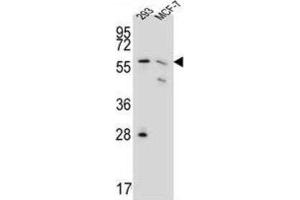 Western Blotting (WB) image for anti-Phosphogluconate Dehydrogenase (PGD) antibody (ABIN3002350) (PGD 抗体)