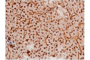 Immunohistochemistry (IHC) image for anti-Signal Transducer and Activator of Transcription 3 (Acute-Phase Response Factor) (STAT3) (pTyr705) antibody (ABIN6255995)