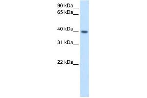 ITGB1BP2 antibody used at 2. (ITGB1BP2 抗体)