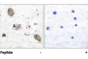 Immunohistochemical analysis of paraffin-embedded human brain tissue using LYN polyclonal antibody . (CD180 抗体)