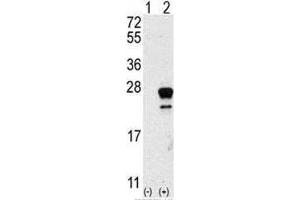 Western blot analysis of NRAS antibody and 293 cell lysate either nontransfected (Lane 1) or transiently transfected with the NRAS gene (2). (GTPase NRas 抗体  (AA 72-101))