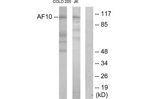 Western blot analysis of extracts from COLO205 cells and Jurkat cells, using AF10 antibody. (MLLT10 抗体  (Internal Region))