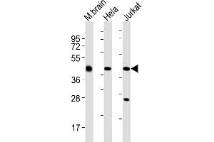 All lanes : Anti-GLUL Antibody (N-term) at 1:2000 dilution Lane 1: mouse brain lysates Lane 2: Hela whole cell lysates Lane 3: Jurkat whole cell lysates Lysates/proteins at 20 μg per lane. (GLUL 抗体  (N-Term))