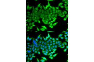 Immunofluorescence analysis of A549 cells using TTF2 antibody. (TTF2 抗体)