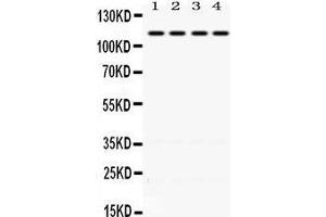 Western Blotting (WB) image for anti-Nuclear Receptor Subfamily 3, Group C, Member 2 (NR3C2) (AA 950-984), (C-Term) antibody (ABIN3043575) (NR3C2 抗体  (C-Term))