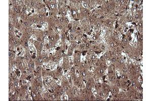 Image no. 1 for anti-Tripartite Motif Containing 38 (TRIM38) (AA 1-265) antibody (ABIN1490685) (TRIM38 抗体  (AA 1-265))