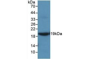 Western Blotting (WB) image for anti-Matrix Metallopeptidase 9 (Gelatinase B, 92kDa Gelatinase, 92kDa Type IV Collagenase) (MMP9) (AA 226-391) antibody (ABIN7427384)