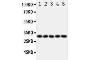 Anti-LOX 1 antibody, Western blotting All lanes: Anti LOX 1  at 0. (OLR1 抗体  (N-Term))