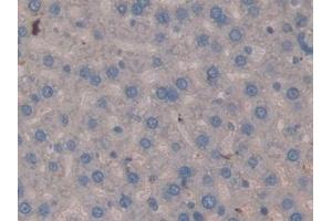 Detection of MMP3 in Rat Liver Tissue using Polyclonal Antibody to Matrix Metalloproteinase 3 (MMP3) (MMP3 抗体  (AA 98-475))