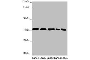 Western blot All lanes: GNB2 antibody at 2. (GNB2 抗体  (AA 1-340))