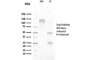 SDS-PAGE Analysis Purified TFF1/ps2 Mouse Monoclonal Antibody (TFF1/2133). (TFF1 抗体)