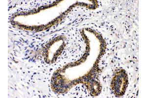 Immunohistochemistry (IHC) image for anti-Glutamate Decarboxylase 2 (Pancreatic Islets and Brain, 65kDa) (GAD2) (AA 131-164), (N-Term) antibody (ABIN5518755)