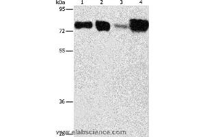Western blot analysis of Hepg2 and hela cell, human fetal kidney and liver tissue, using ACSL4 Polyclonal Antibody at dilution of 1:650 (ACSL4 抗体)