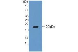 Detection of Recombinant MRPL1, Human using Polyclonal Antibody to Mitochondrial Ribosomal Protein L1 (MRPL1) (MRPL1 抗体  (AA 147-285))