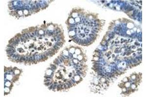 Image no. 1 for anti-Sonic Hedgehog (SHH) (N-Term) antibody (ABIN6736667) (Sonic Hedgehog 抗体  (N-Term))