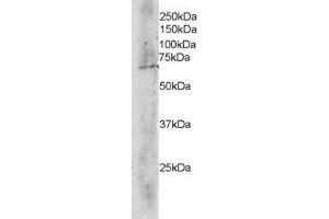 Image no. 1 for anti-Transducin (Beta)-Like 1X-Linked (TBL1X) (C-Term) antibody (ABIN374165) (TBL1X 抗体  (C-Term))