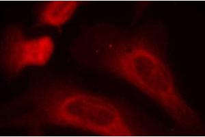 Immunofluorescence analysis of methanol-fixed HeLa cells using Phospho-STAT1(S727) Polyclonal Antibody (STAT1 抗体  (pSer727))