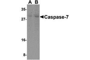 Western Blotting (WB) image for anti-Caspase 7, Apoptosis-Related Cysteine Peptidase (CASP7) (N-Term) antibody (ABIN1031300) (Caspase 7 抗体  (N-Term))