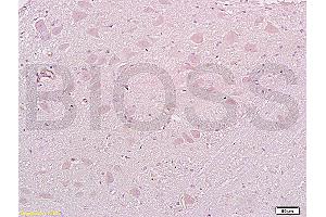 Formalin-fixed and paraffin embedded: rat brain tissue labeled with Anti-MAP1A Polyclonal Antibody (ABIN735308), Unconjugated at 1:200, followed by conjugation to the secondary antibody and DAB staining (MAP1A 抗体  (AA 2651-2750))