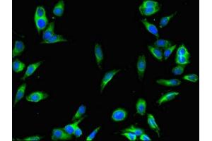 Immunofluorescent analysis of Hela cells using ABIN7168833 at dilution of 1:100 and Alexa Fluor 488-congugated AffiniPure Goat Anti-Rabbit IgG(H+L) (SENP1 抗体  (AA 63-214))